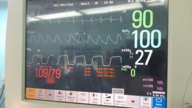 أطباء جراحة المسالك البولية يجرون 3 عمليات جراحية